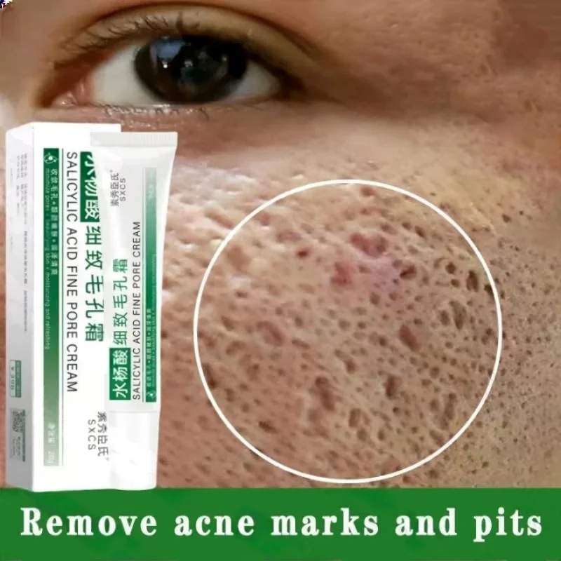 Skincare Salicylic Acid - Salicylic Acid Pore Clearing Cream Shrink