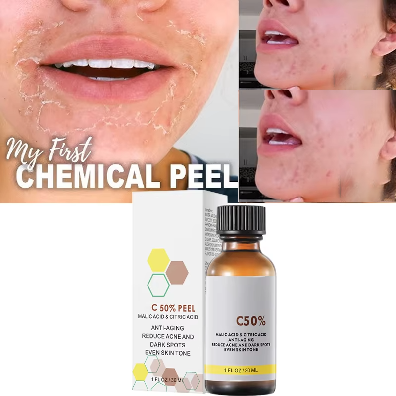 Skincare Salicylic Acid - With Malic Acid And Citric Acid