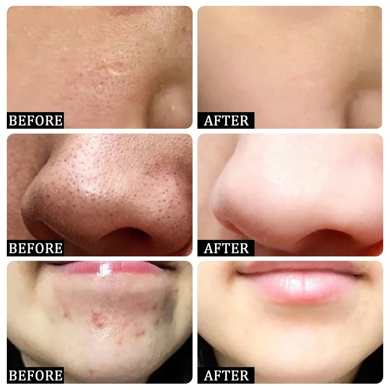 Salicylic Acid Pore Clearing C - огляд і ціна Skincare Salicylic Acid