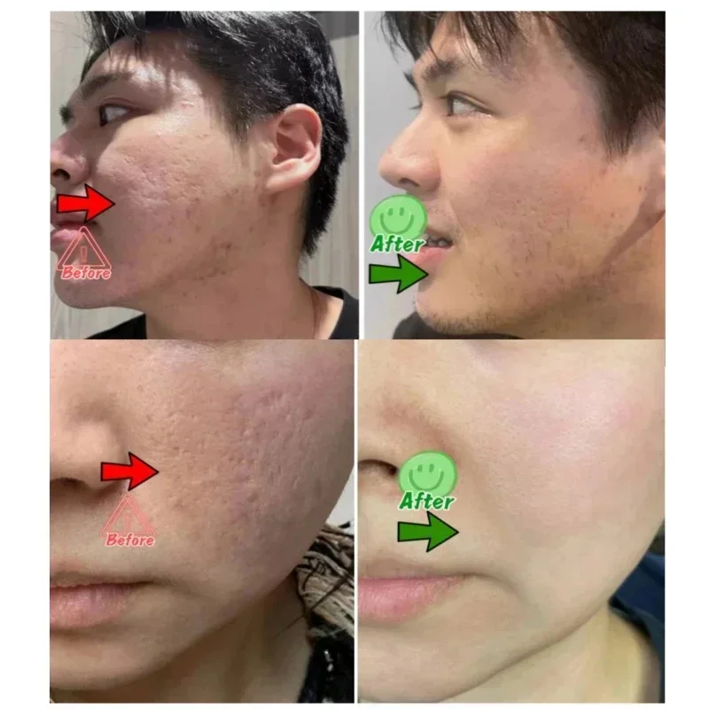 Salicylic Acid Pore Clearing C - огляд і ціна Skincare Salicylic Acid