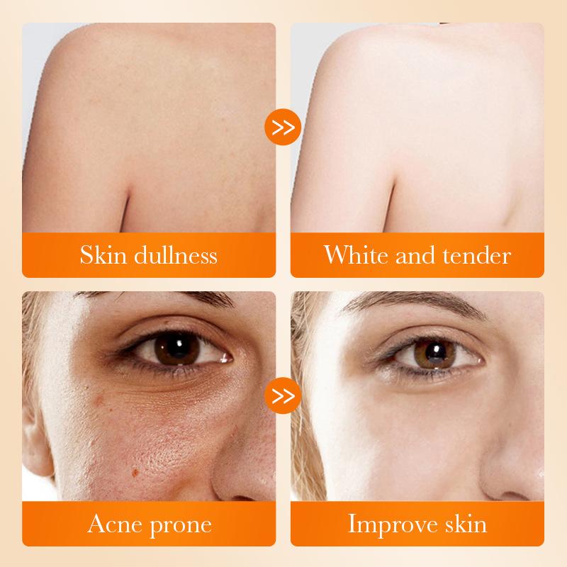 1Pc SADOER Kojic Acid Facial S - огляд і ціна Kojic Acid Soap