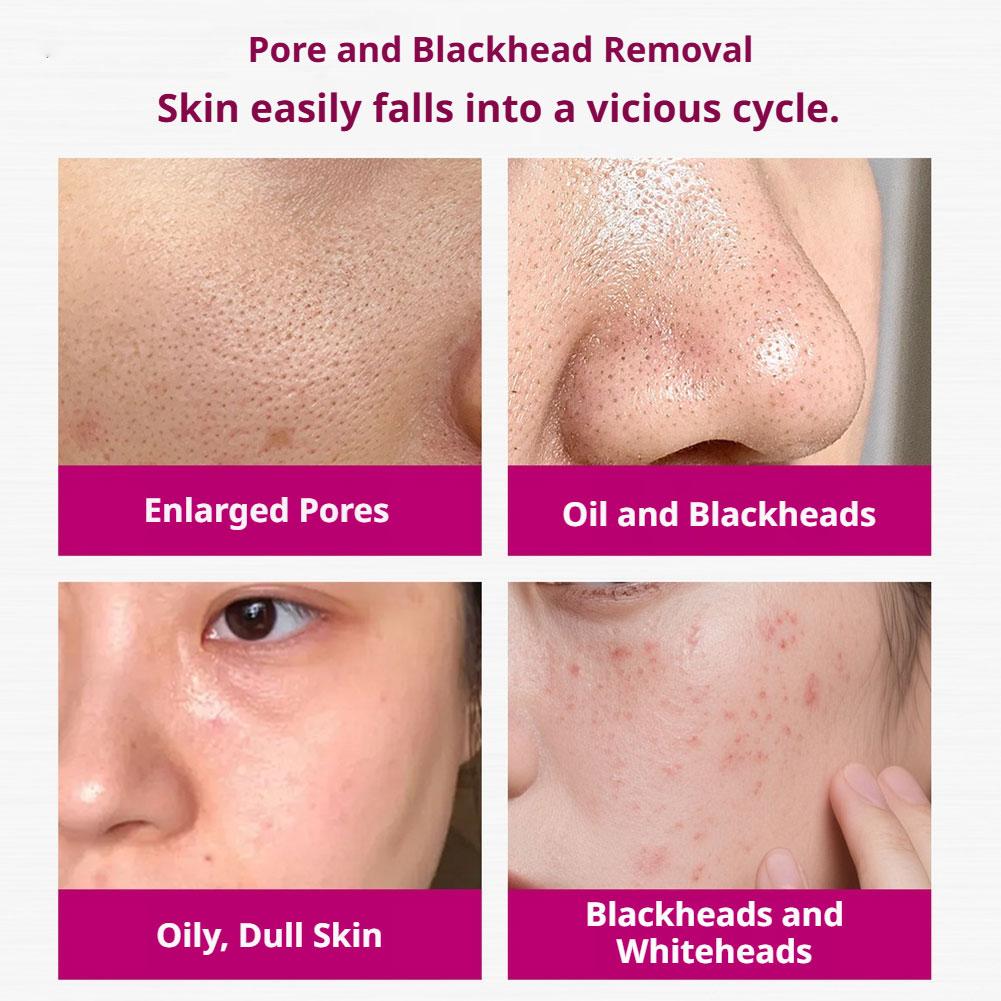 Salicylic Acid Shrink Pores Se - огляд і ціна Skincare Salicylic Acid
