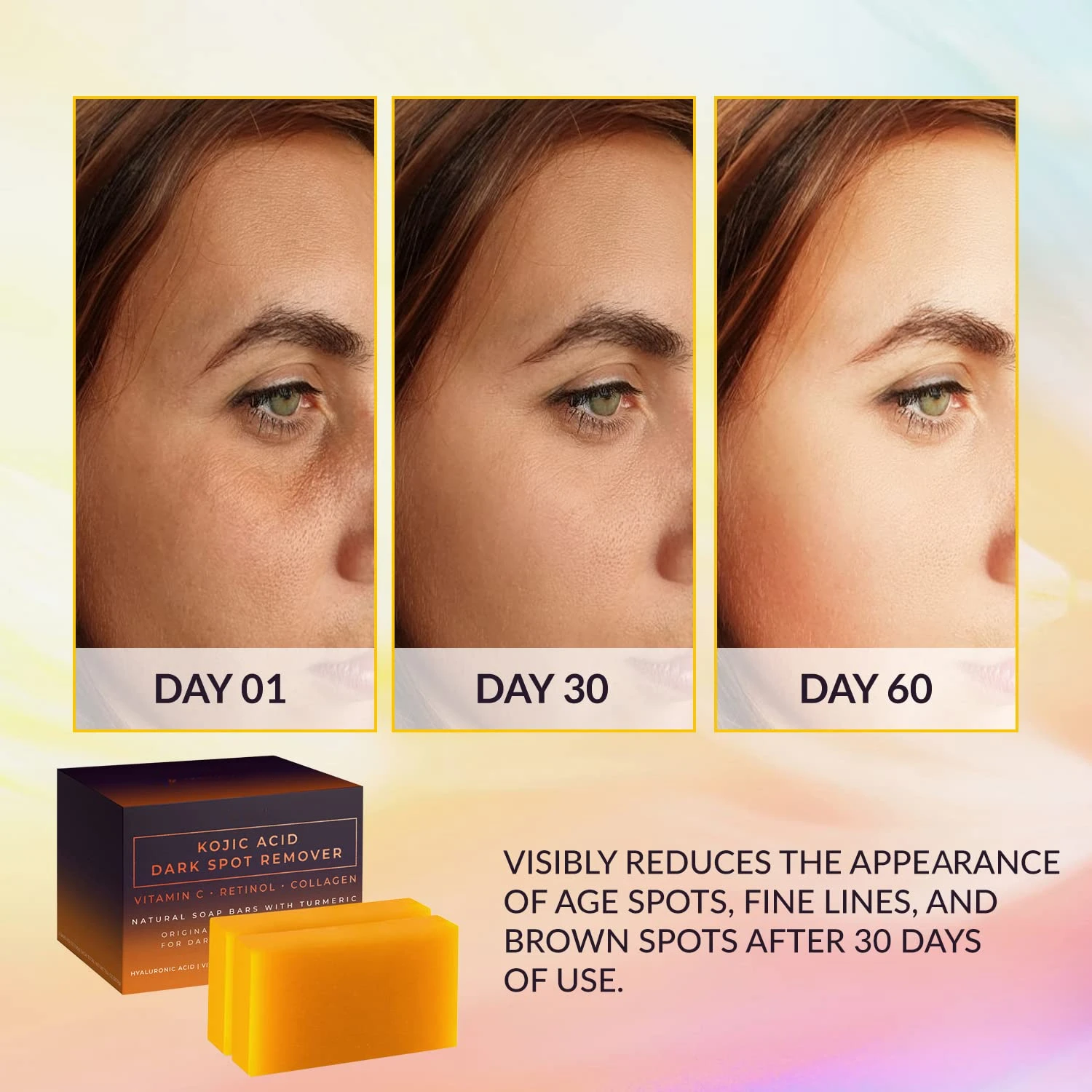 Kojic Acid Dark Spot Remover W - огляд і ціна Kojic Acid Soap
