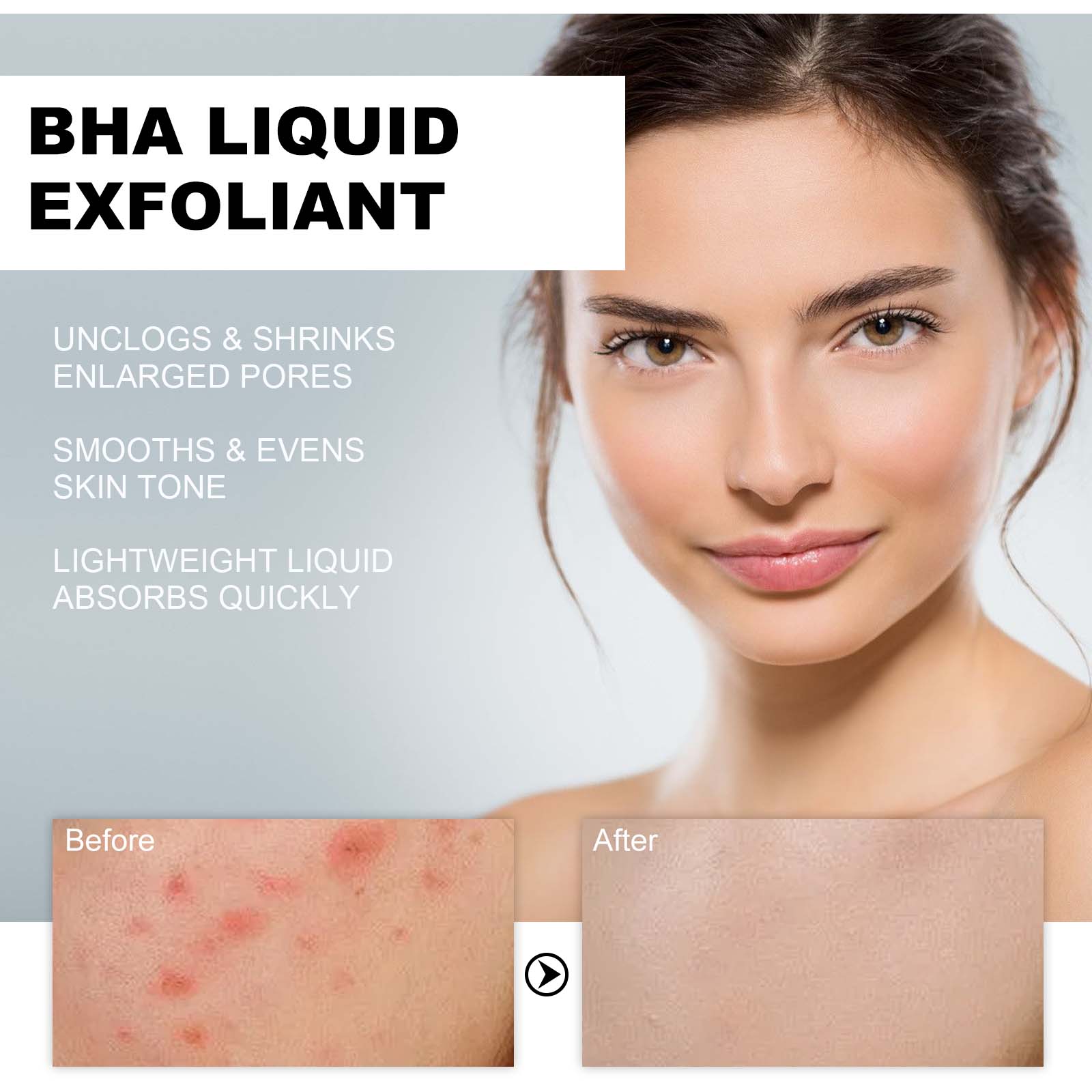 2% Salicylic Acid Liquid Exfol - огляд і ціна Skincare Salicylic Acid