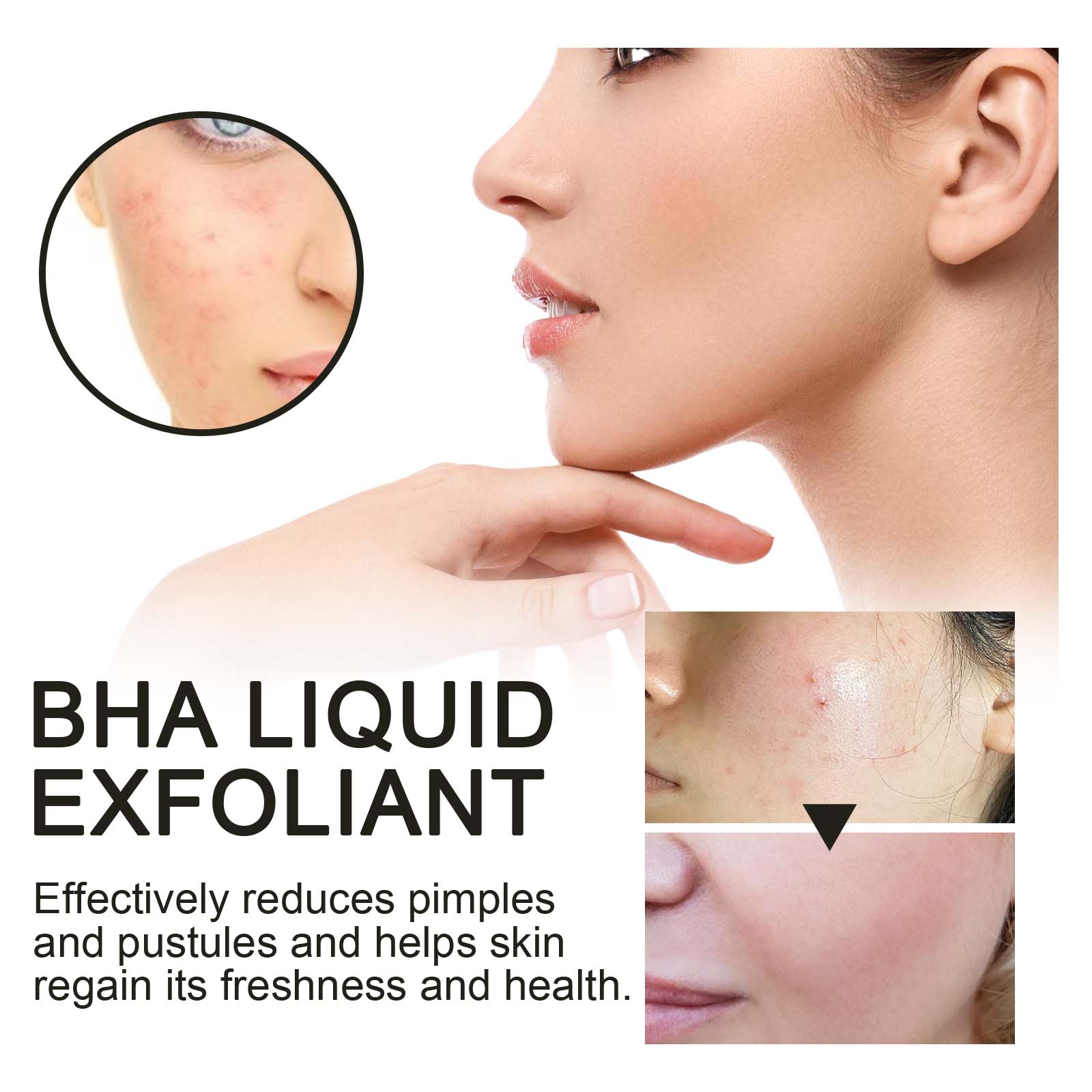 2% Salicylic Acid Liquid Exfol - огляд і ціна Skincare Salicylic Acid