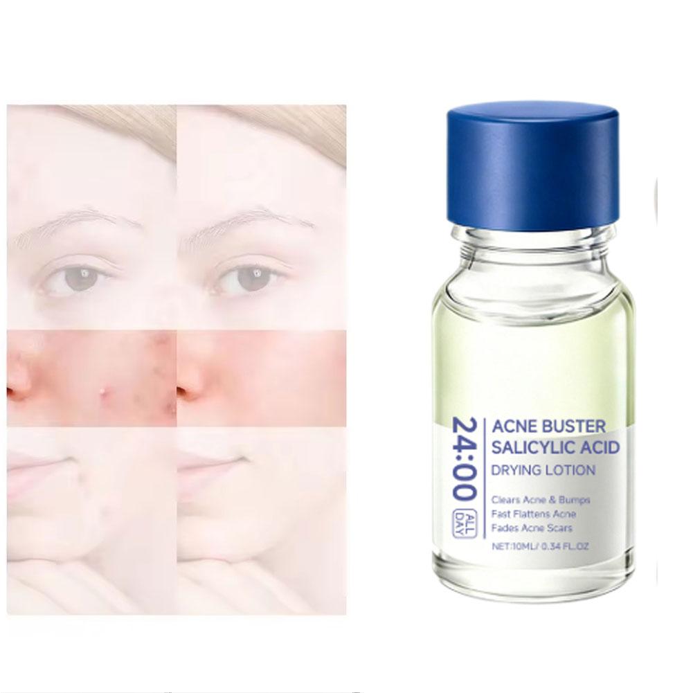 Salicylic Acid Essence Treatme - огляд і ціна Skincare Salicylic Acid