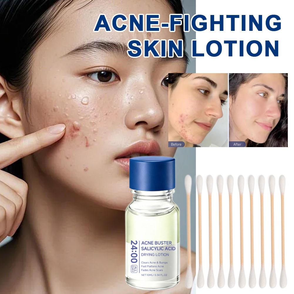 Salicylic Acid Essence Treatme - огляд і ціна Skincare Salicylic Acid