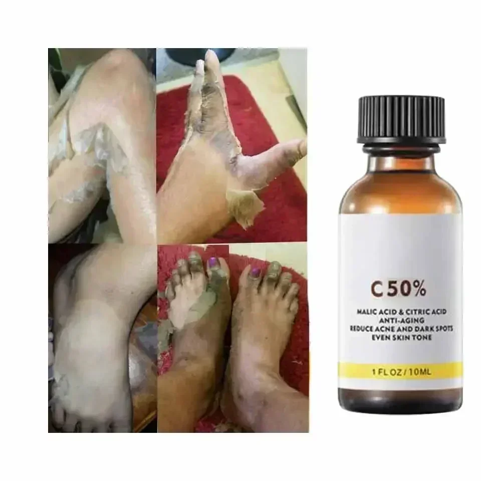 With Malic Acid And Citric Aci - огляд і ціна Skincare Salicylic Acid